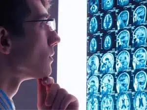 Doctor looks at mri to determine the cause of Seasonal Allergies After a Traumatic Brain Injury.